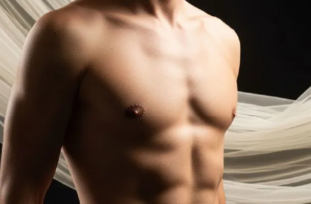 Gynecomastia Surgery