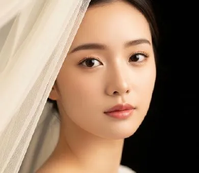 Asian Nose Surgery — photo 4